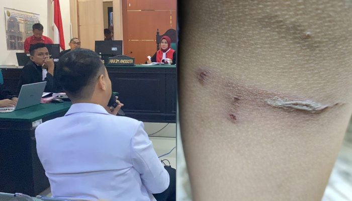 Sidang Lanjutan Guru Supriyani: Dokter Ahli Forensik Ungkap Luka di Paha Korban Bukan Karena Sapu